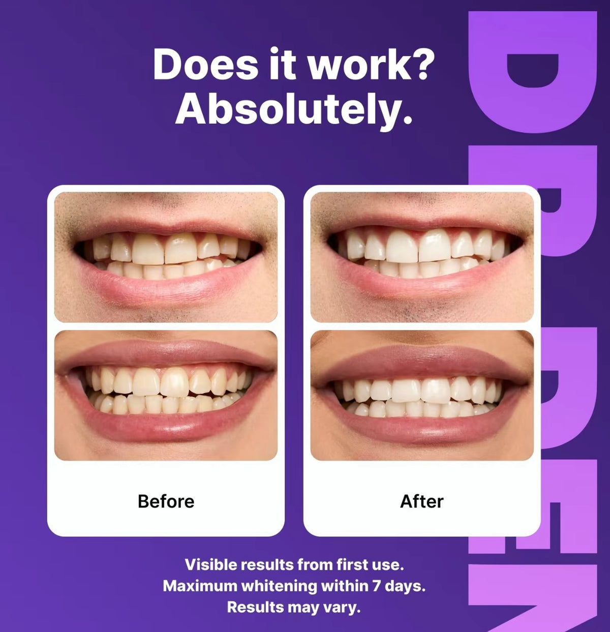 DR DENT- Purple Teeth Whitening Strips